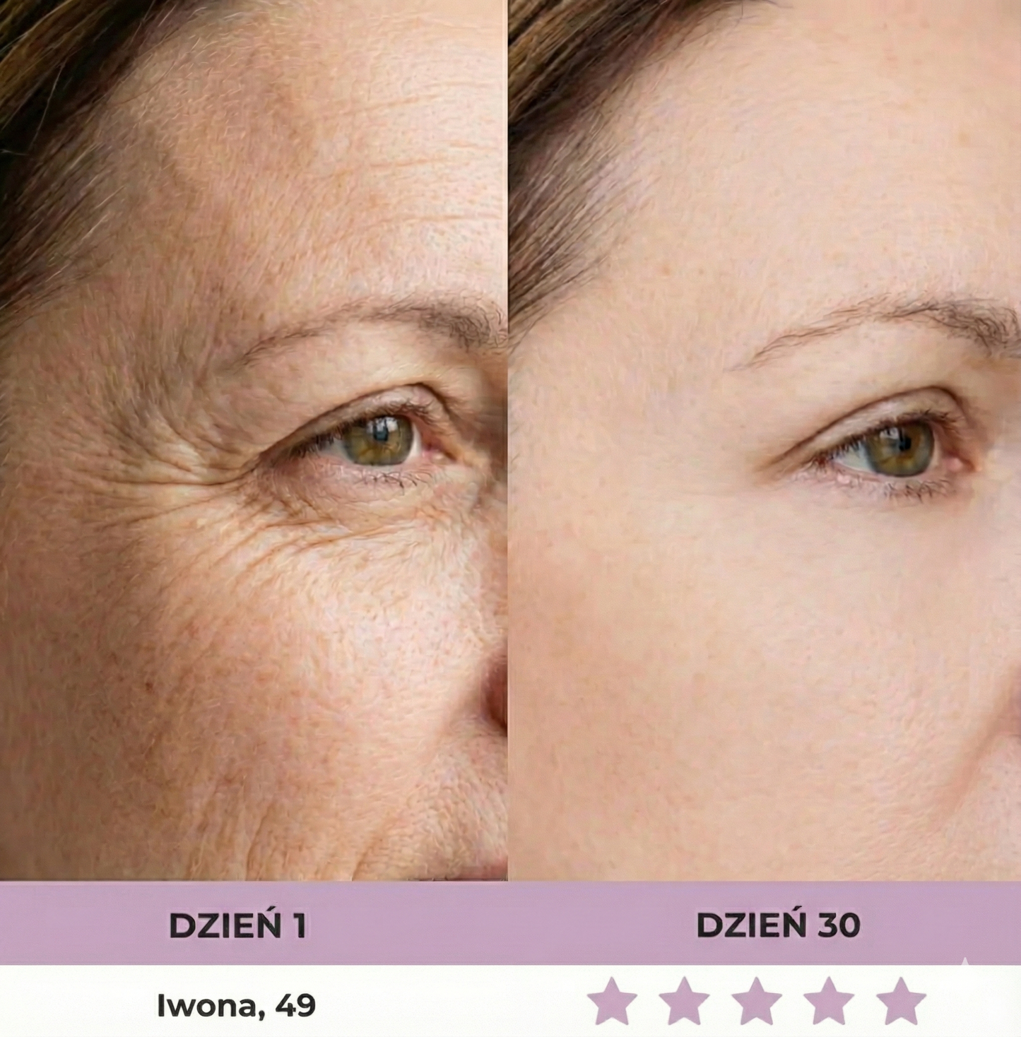 MediLight Pro® - Profesjonalne urządzenie LED dla cery