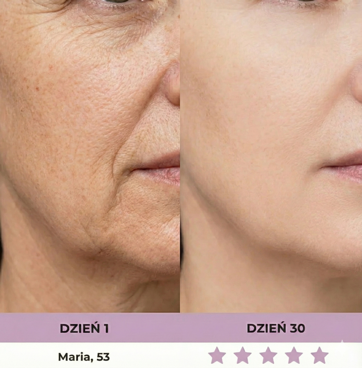 MediLight Pro® - Profesjonalne urządzenie LED dla cery